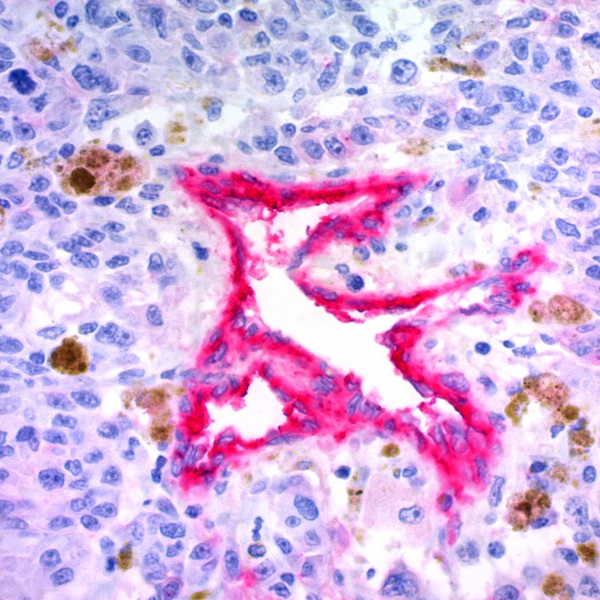 Melanoma Associated Antigen; Clone KBA.62 (Ready-To-Use)